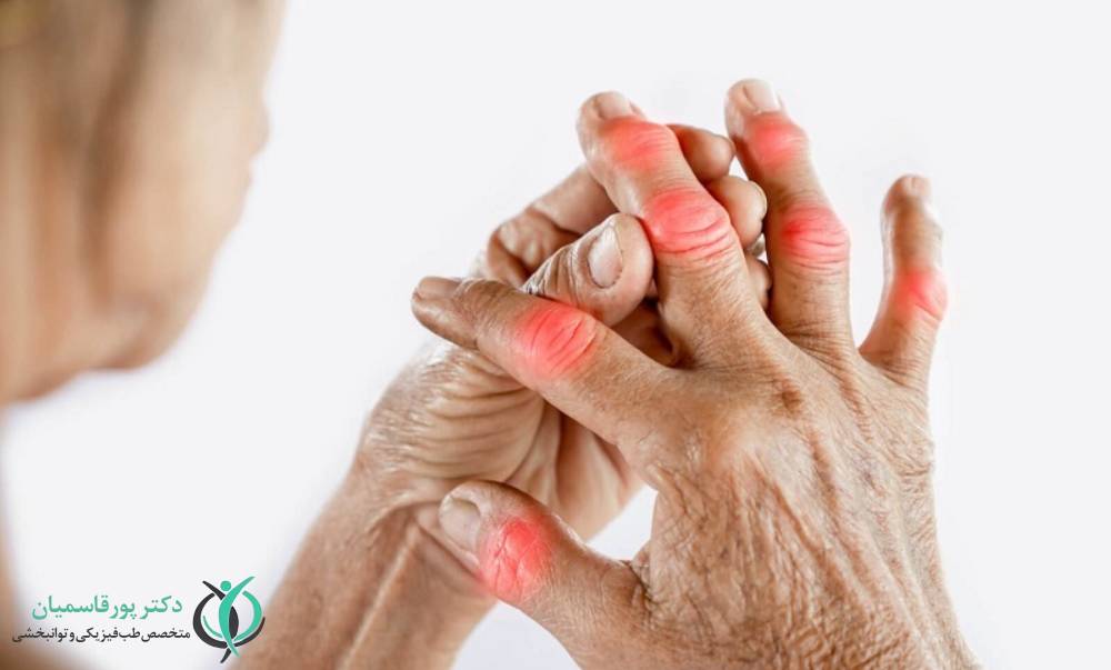 روماتیسم مفصلی