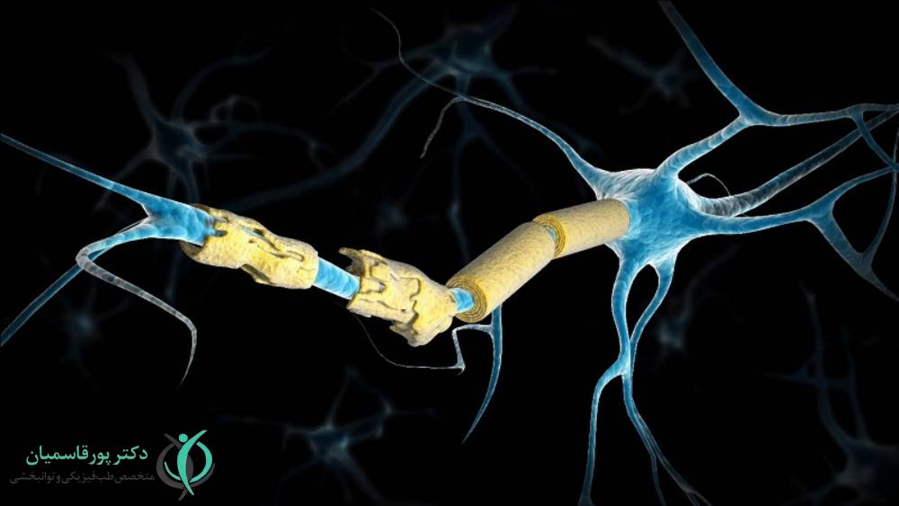 بیماری ام اس یا اسکلروز چندگانه