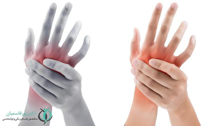 گزگز و خواب رفتن دست نشانه چیست؟ چگونه درمان می‌شود؟