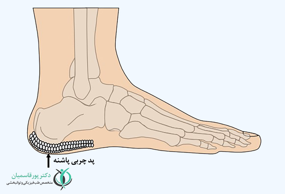 پد چربی پاشنه