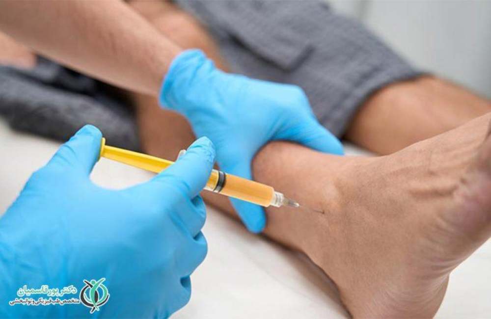 تزریق پی آر پی مچ پا؛ همراه با فیلم مراحل و بررسی هزینه‌ها