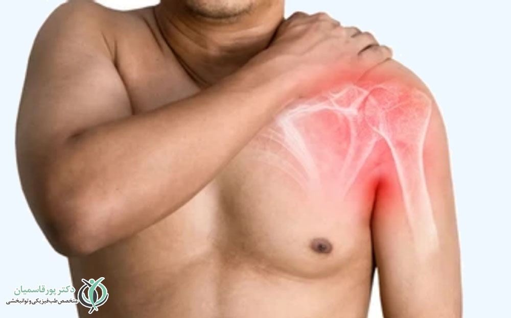 آسیبهای مزمن شانه