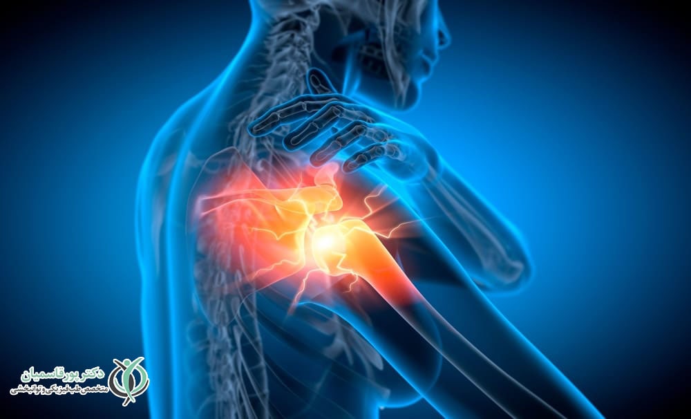 آسیبهای پیچیده شانه