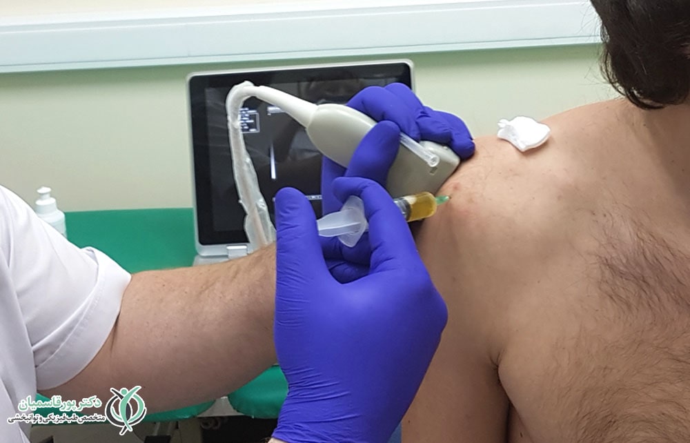 تزریق محلول پی آر پی