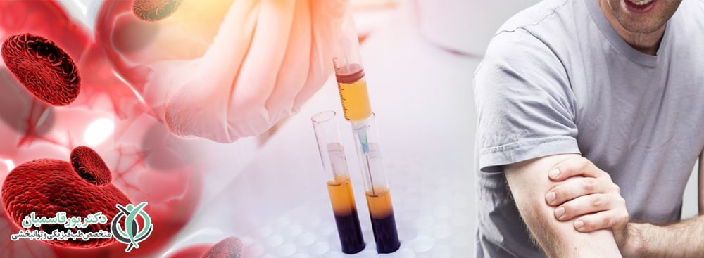 فرآیند تزریق پی آر پی در شانه