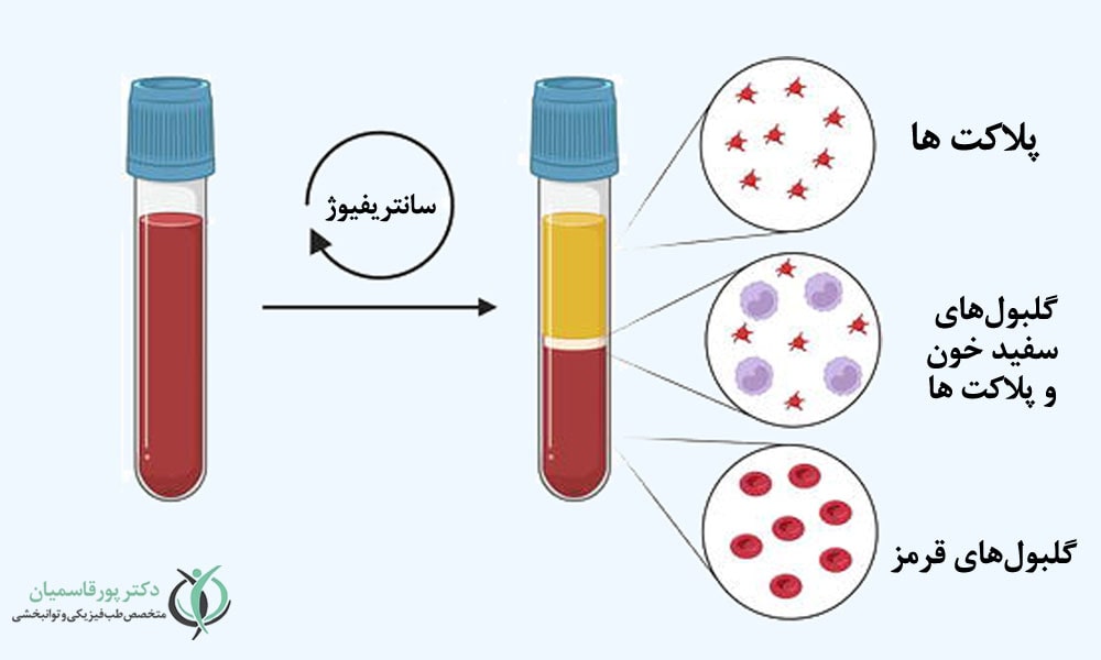 عملکرد پی آر پی