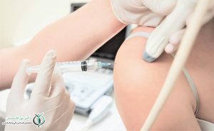 تزریق پی‌ارپی شانه