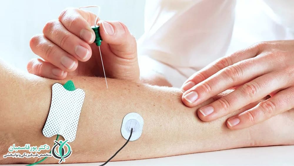 نوار عصب و عضله