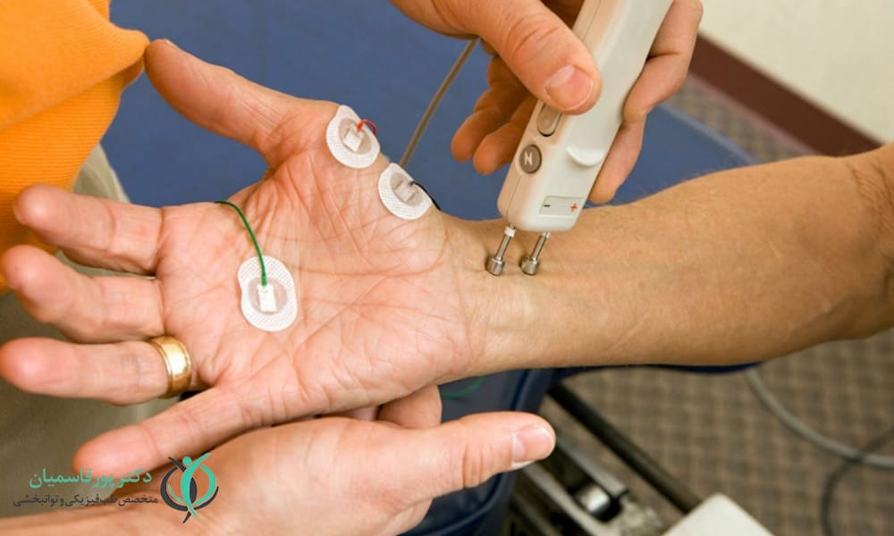 آزمایش هدایت عصبی