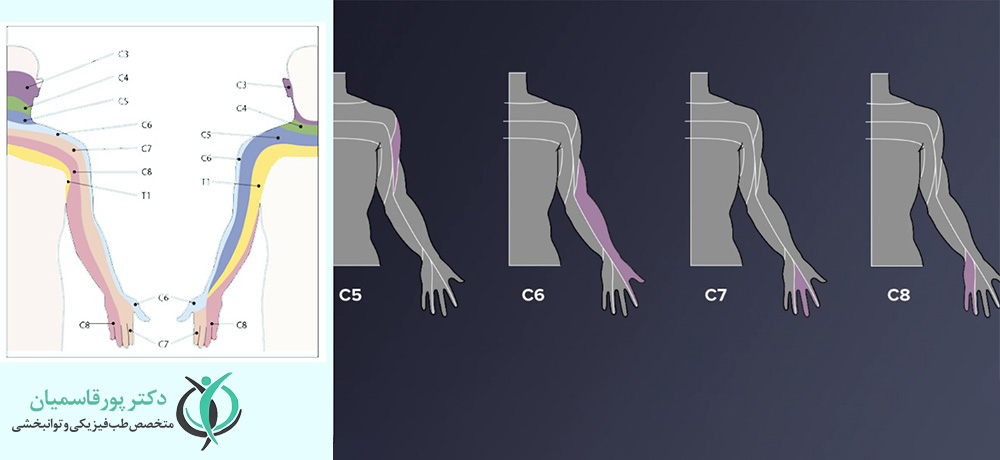 مشکلات گردن