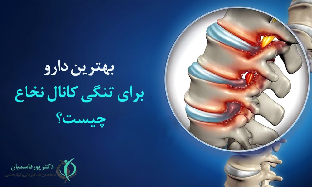 تنگی کانال نخاع